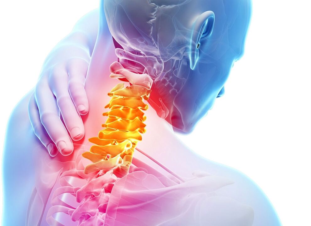 príznaky cervikálnej osteochondrózy